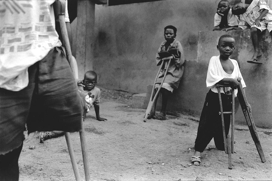 Children with crutches.