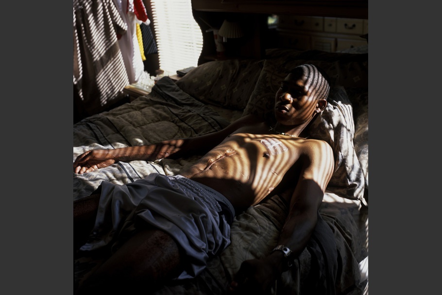 Soldier with scarred stomach on bed with streaked light.
